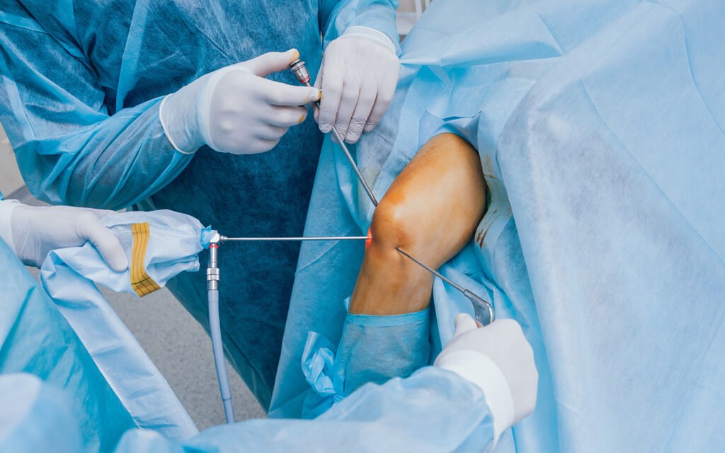knee arthroscopy dr darren paterson